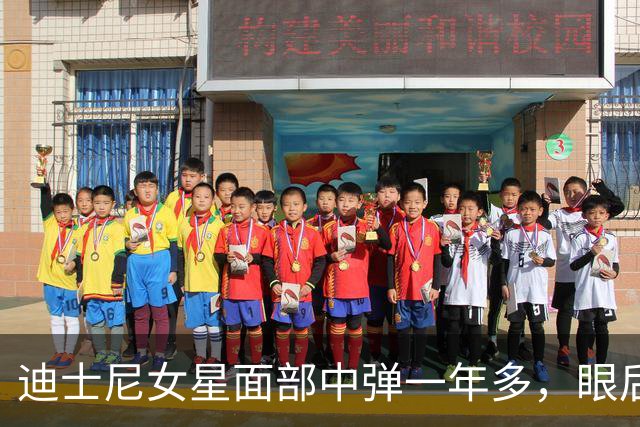 迪士尼女星面部中弹一年多，眼后仍留弹丸：一动就失明